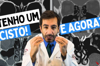cisto tomografia face, sinusite, otorrino em Curitiba , pólipo nasal, cisto de retenção, sinusite com pólipo, cisto seio maxilar,