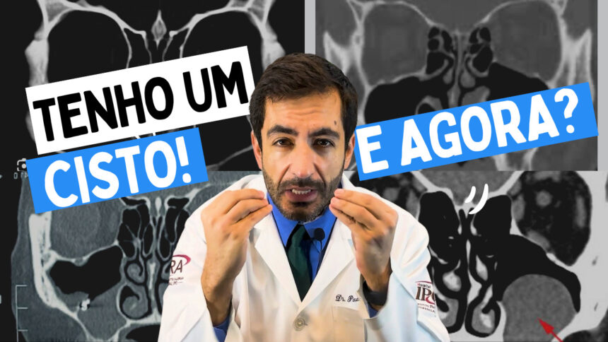 cisto tomografia face, sinusite, otorrino em Curitiba , pólipo nasal, cisto de retenção, sinusite com pólipo, cisto seio maxilar,